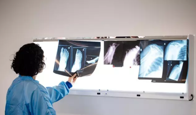 他为什么能跑这么快?! 他为什么能跑这么快?!